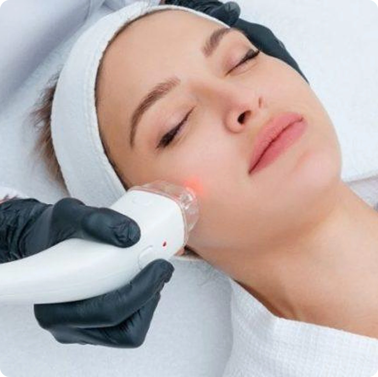 Laser Treatments