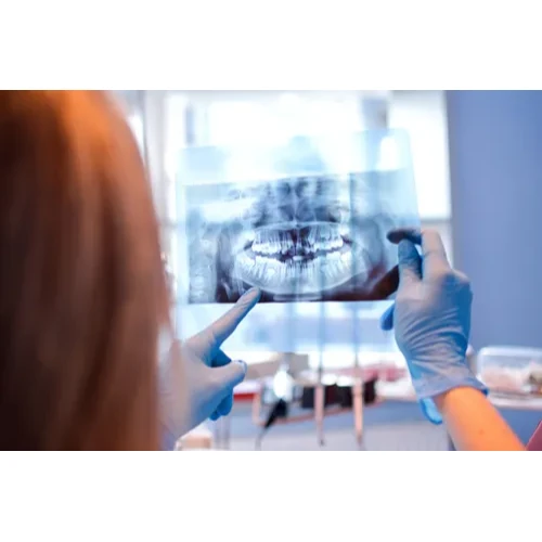 3D X-RAY