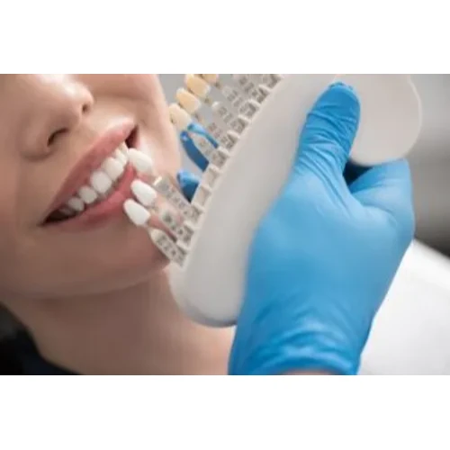 COMPOSITE VENNER 1 TOOTH
