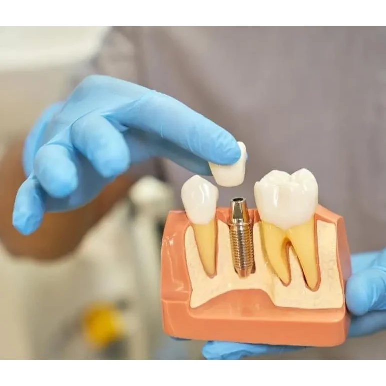implant
