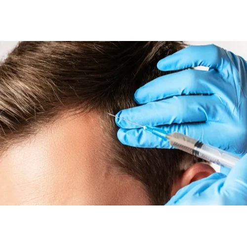 PRP (for hair and face)