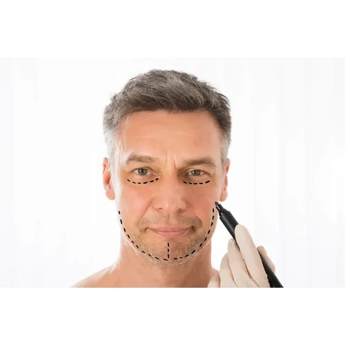 Facelift surgery and rhinoplasty