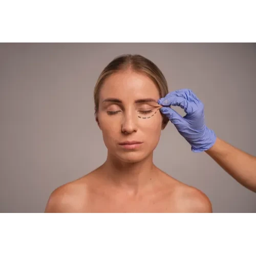 eyelid surgery