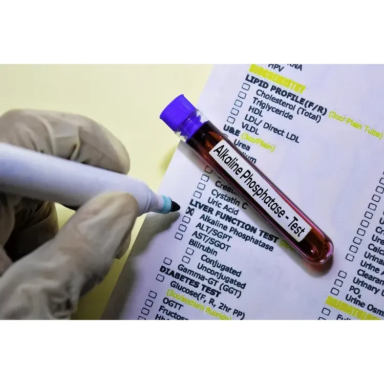 Alkaline Phosphatase