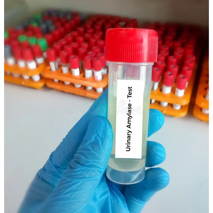 Amylase