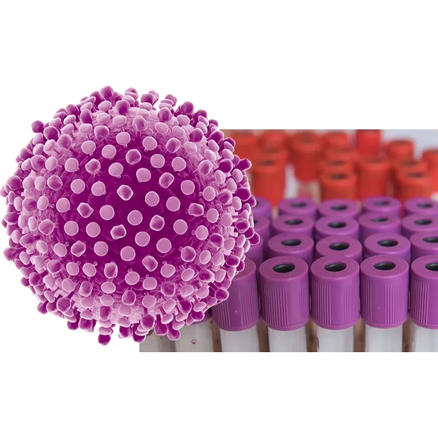 Anti Hepatitis C Virus Antibody