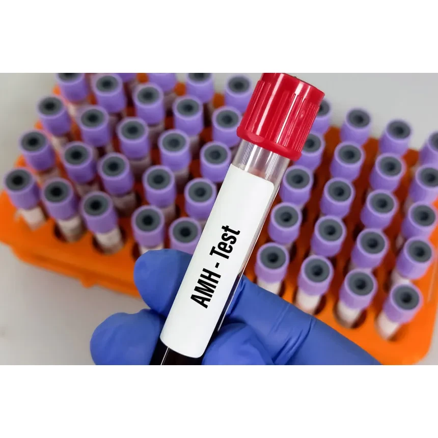 Anti Mullerian Hormone