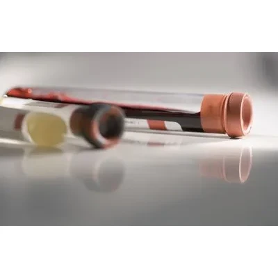 Anti Nuclear Antibodies
