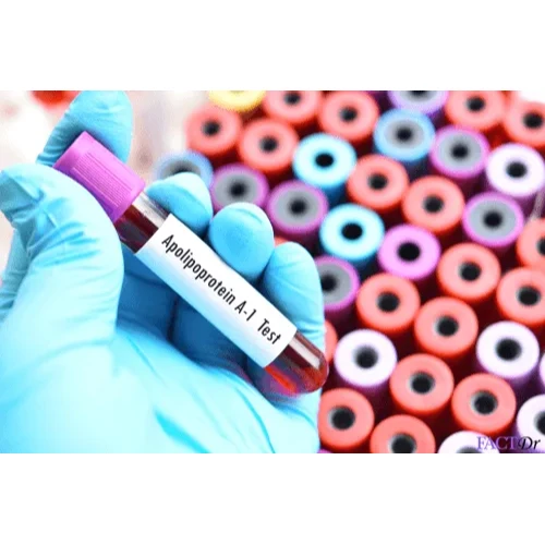 Apolipoprotein - A1