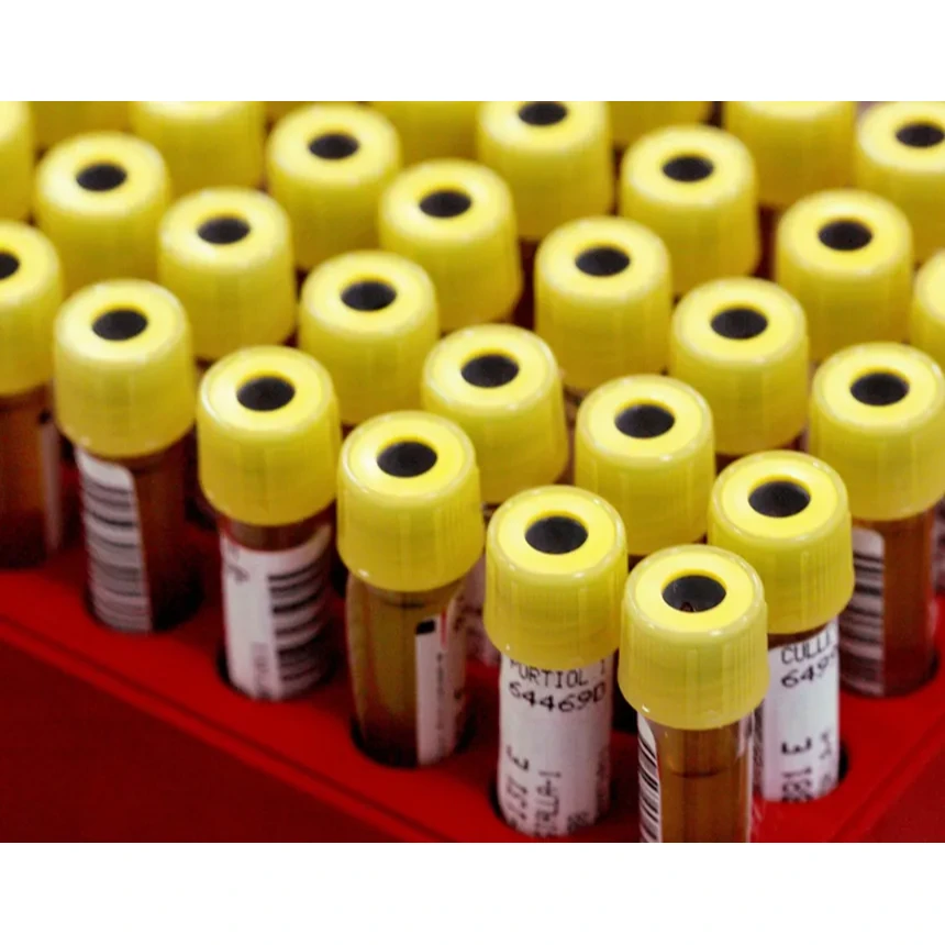 Aspartate Aminotransferase