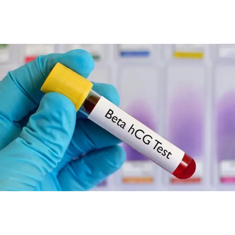 Beta HCG