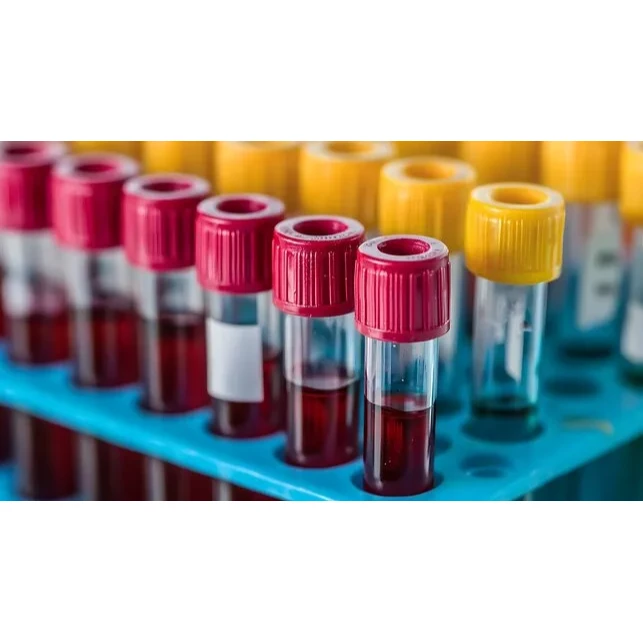 Blood Grouping and Rh Typing