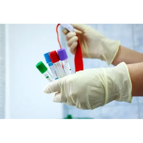 Complete Urine Analysis