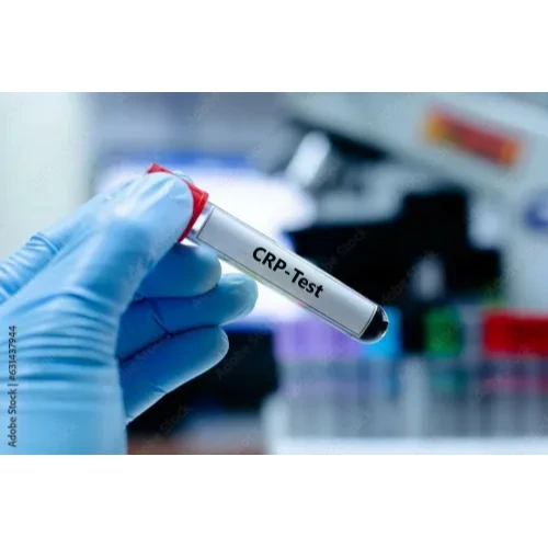 C-Reactive Protein