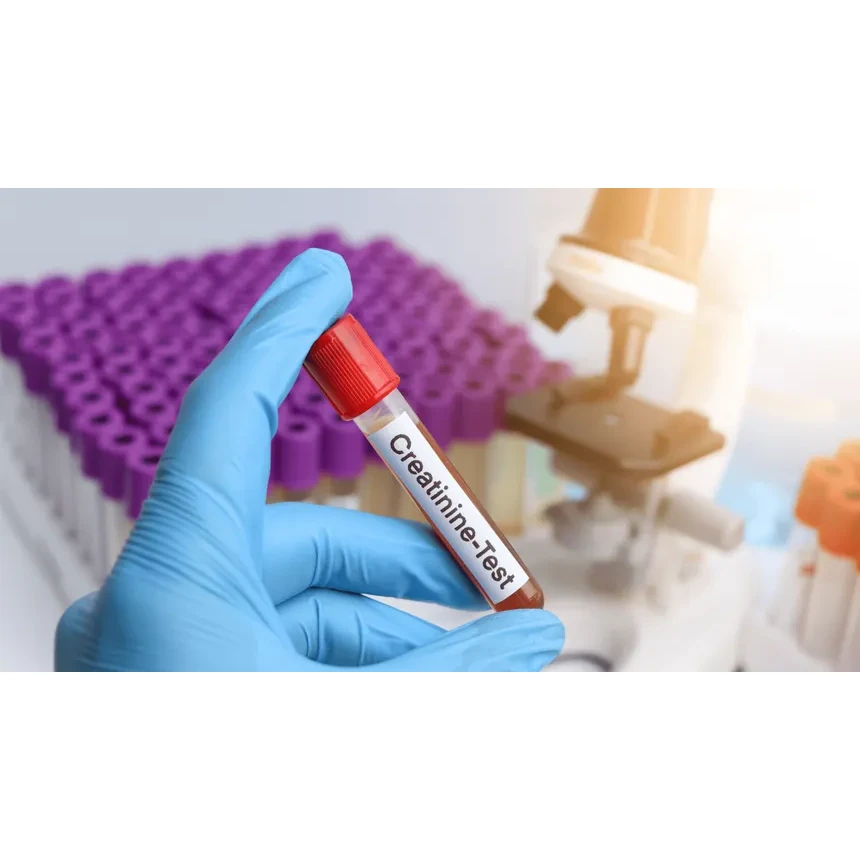 Creatinine-serum