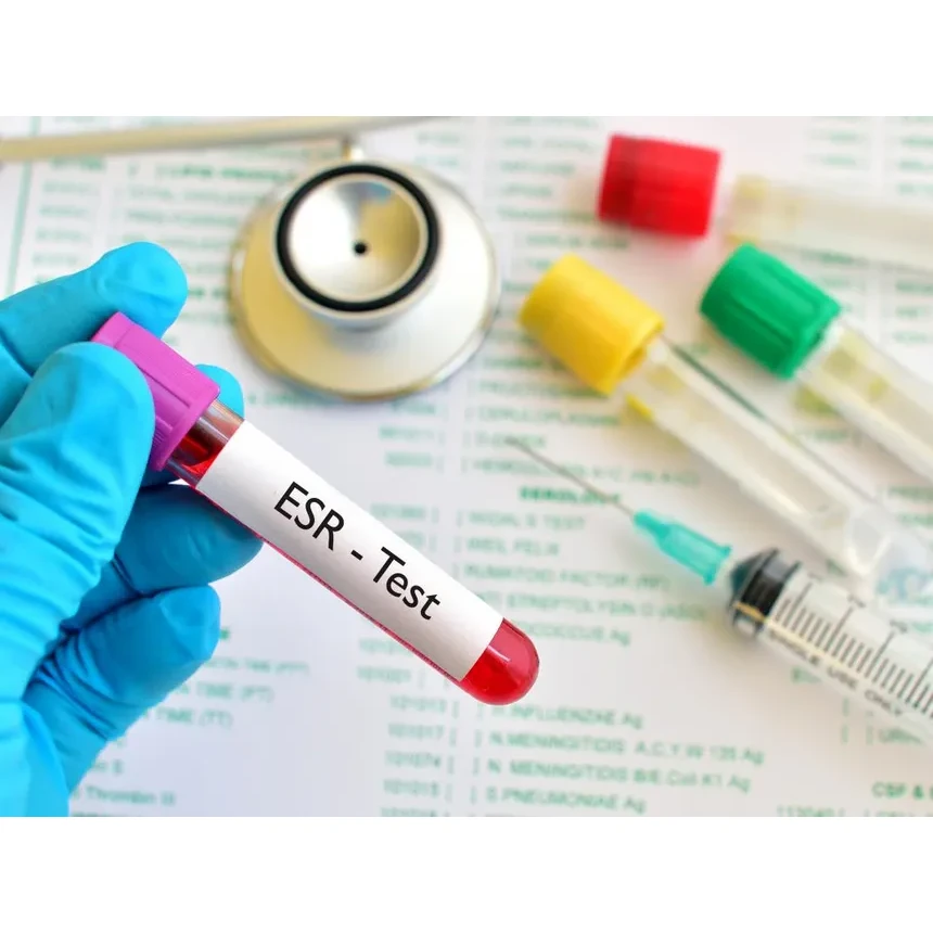 Erythrocytesedimentation Rate