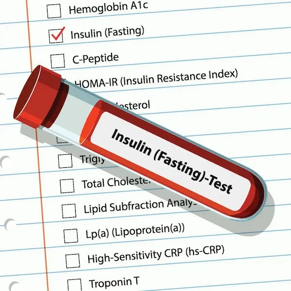Fasting Blood sugar