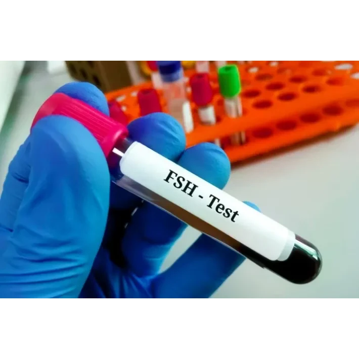 Follicle stimulating Hormone