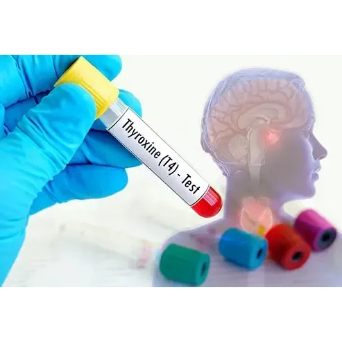 Free Thyroxine