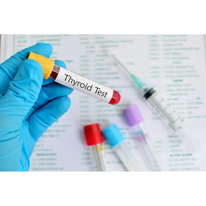 Free Triiodothyronine