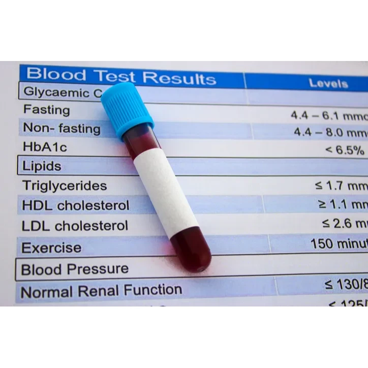 HDL Cholesterol - Direct