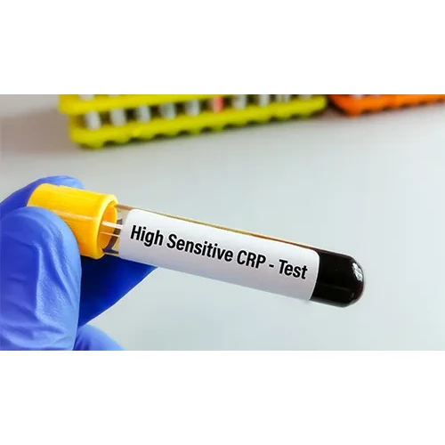 High Sensitivity C-Reactive Protein