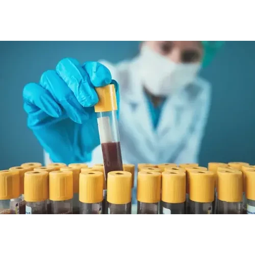 High-Sensitivity Troponin I