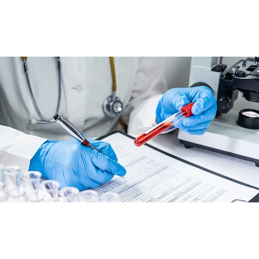 HIV P24 Ag/Ab