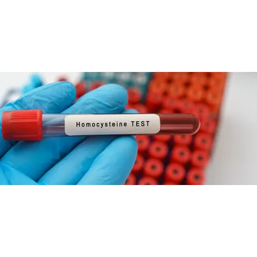 Homocysteine