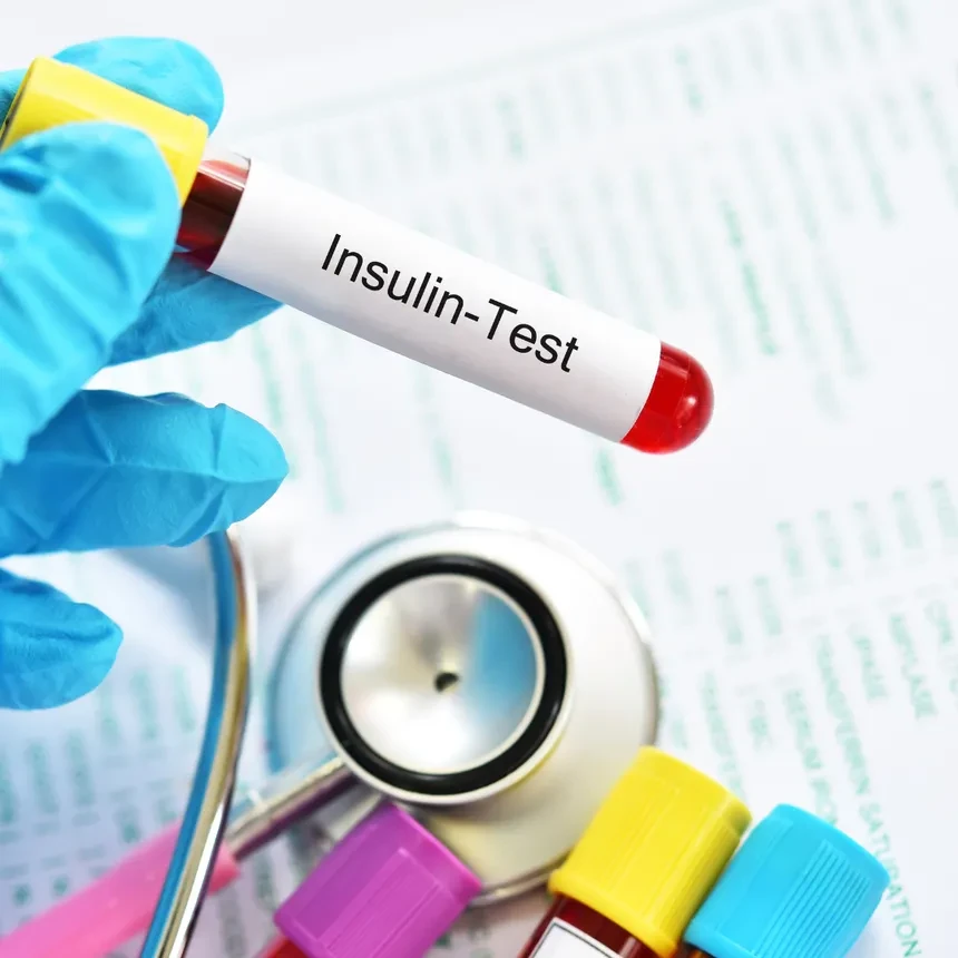 Insulin - Fasting