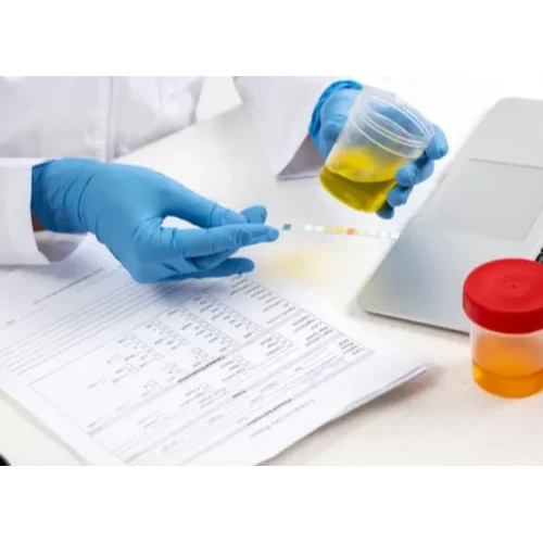 Luteinising Hormone