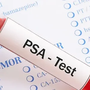 Prostate Specific Antigen