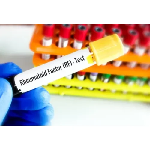 Rheumatoid Factor