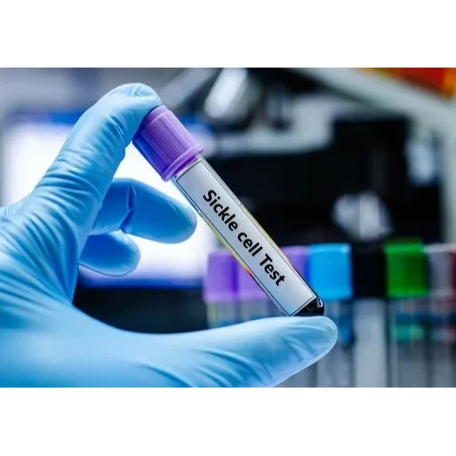 Sickle Cell Test