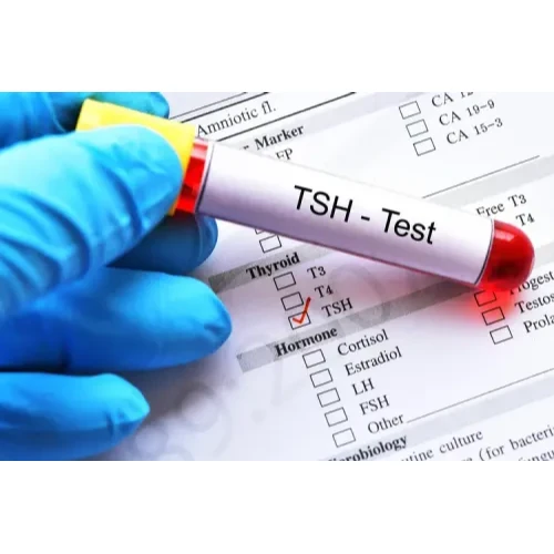 Thyroid Stimulating Hormone