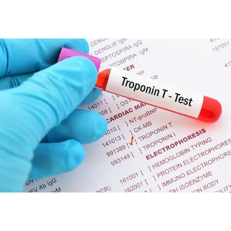 Troponin - I