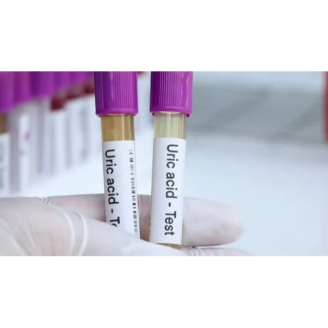 Uric Acid