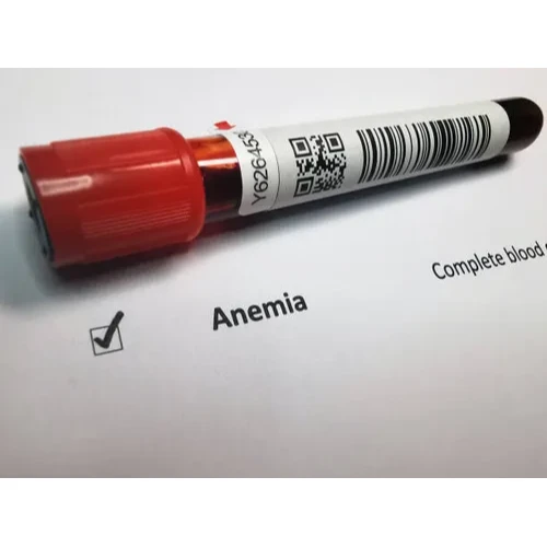 Anemia Profile (17)