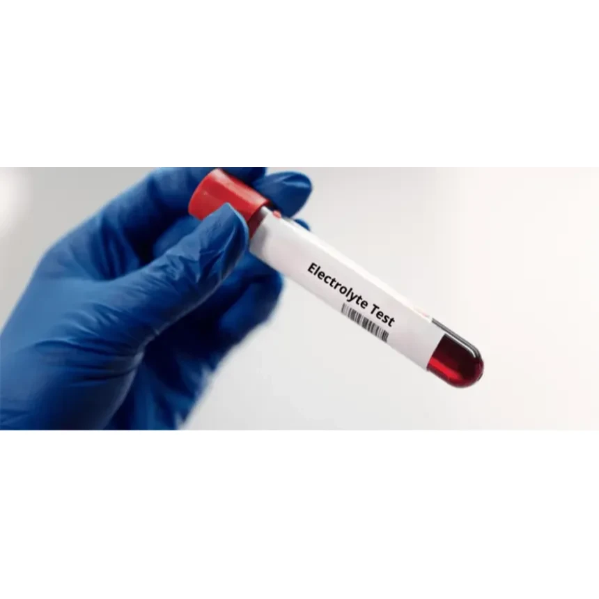 Serum Electrolytes (3)