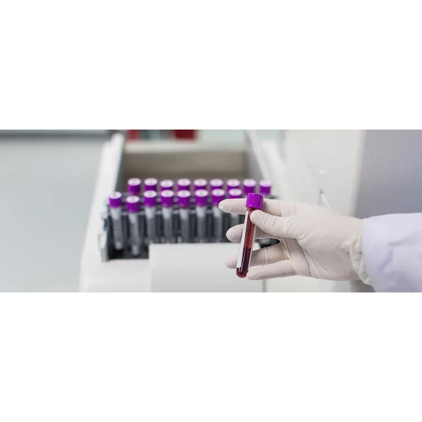 Blood Element Analysis Profile (9)