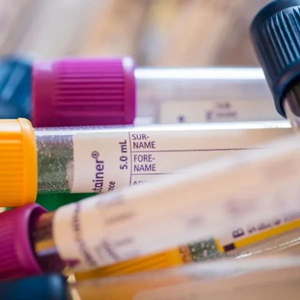 Steroid Profile (13)